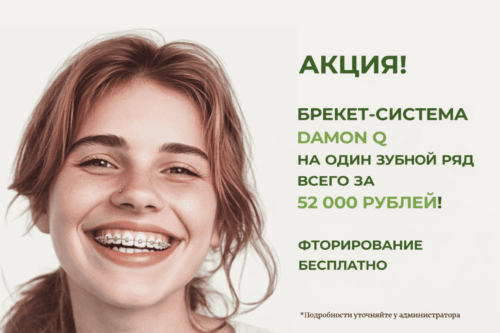 брекеты акция